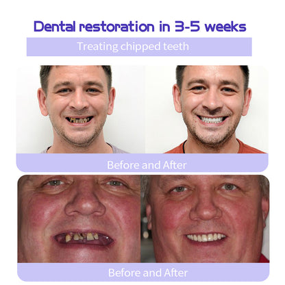 🔥 Final Day 64% OFF 🔥BBOJI™- Fluoride-Free Hydroxyapatite Toothpaste
