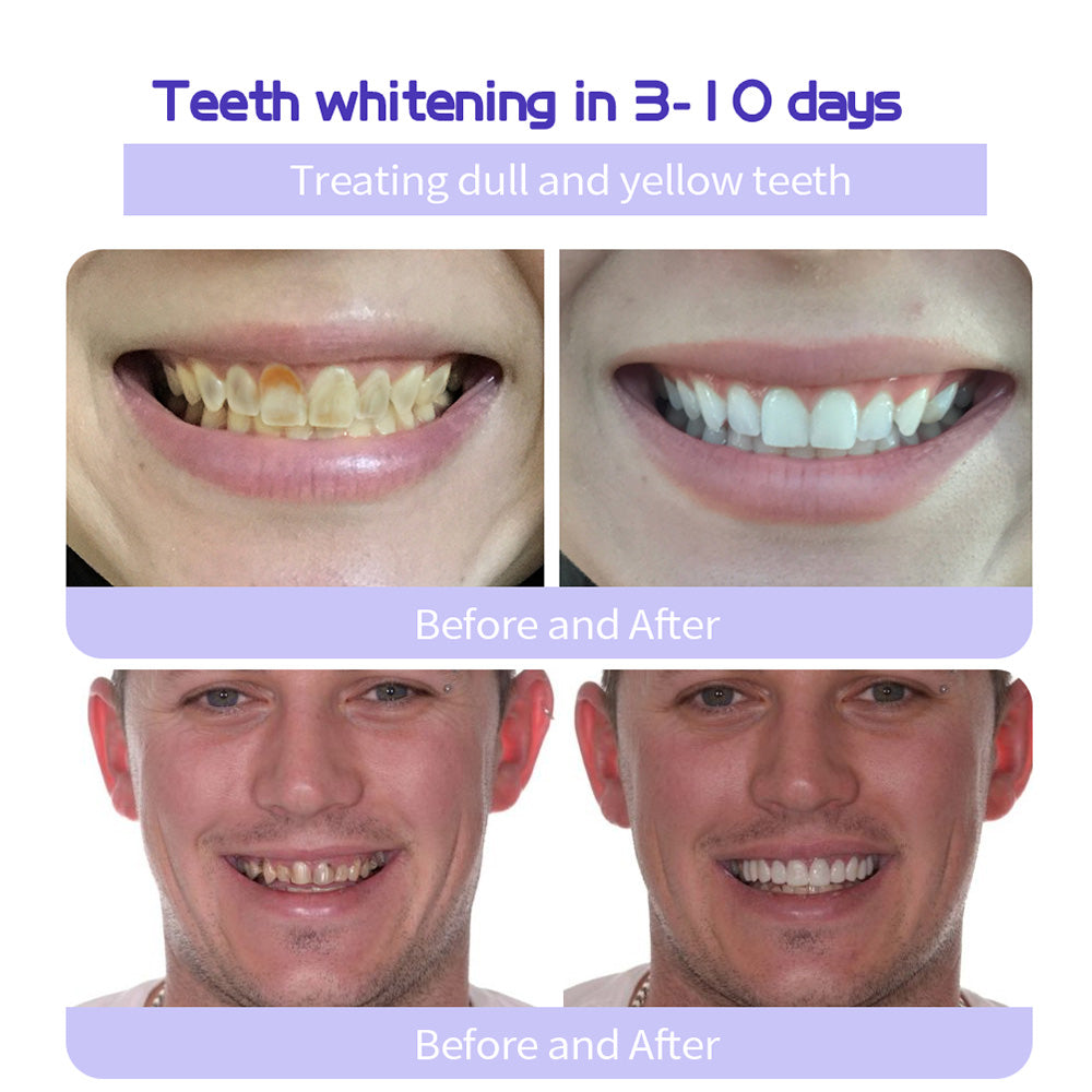 🔥 Final Day 64% OFF 🔥BBOJI™- Fluoride-Free Hydroxyapatite Toothpaste