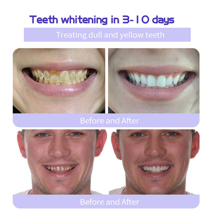 🔥 Final Day 64% OFF 🔥BBOJI™- Fluoride-Free Hydroxyapatite Toothpaste